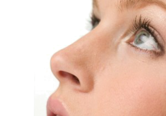 Rinoplastia